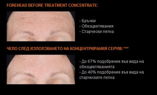 ANEW Genics Before After